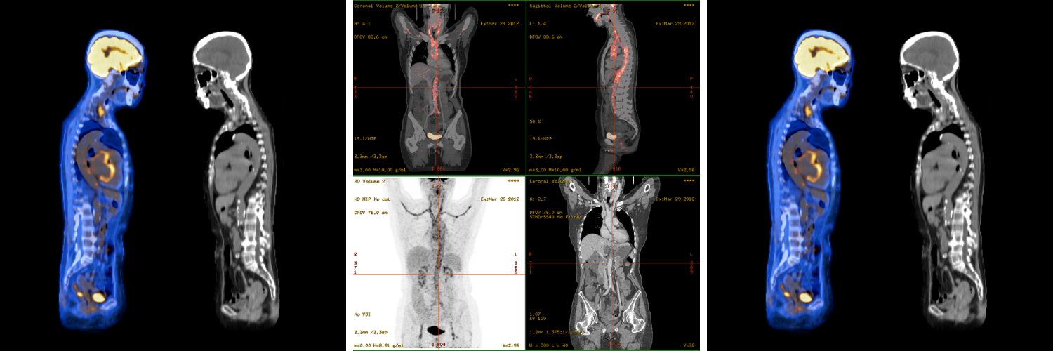 CT/PET Images